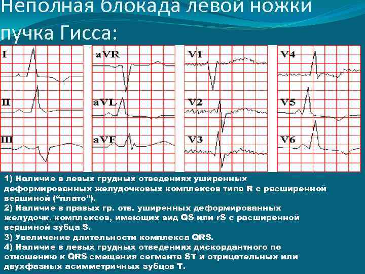 Головокружение
