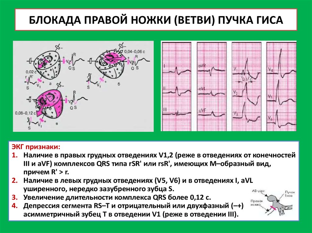 Операция